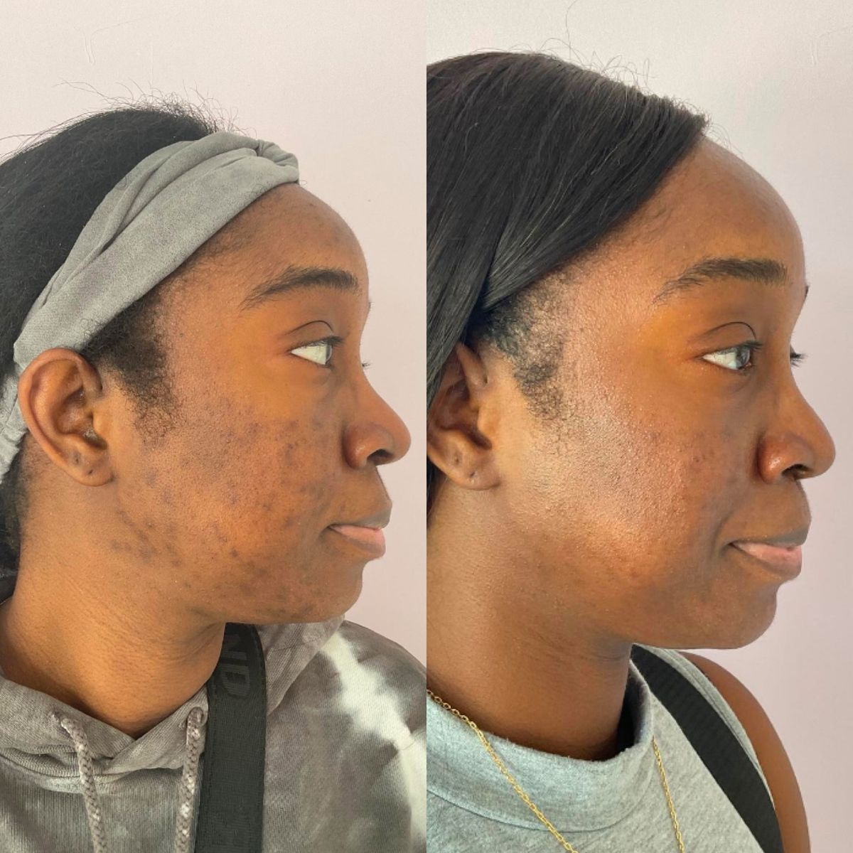The Glass Skin Collection Kit