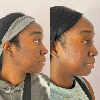 The Glass Skin Collection Kit