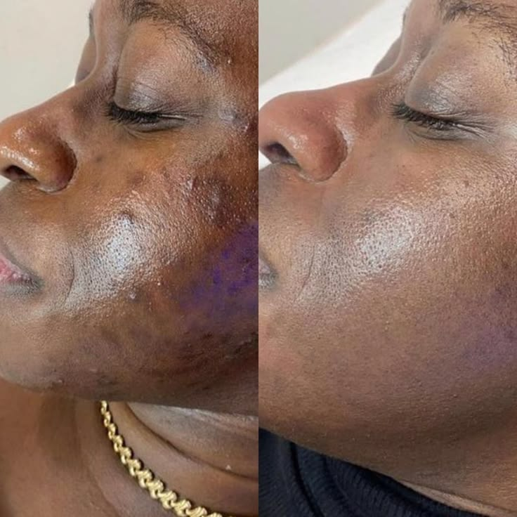 The Glass Skin Collection Kit