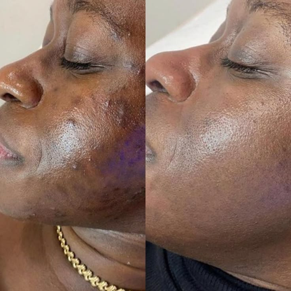 The Glass Skin Collection Kit