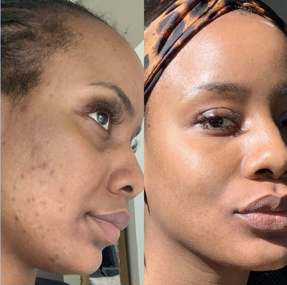 Golden Glow Cleansing Bar